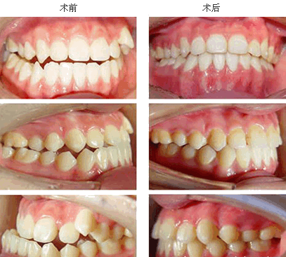 點擊在新窗口中打開圖片