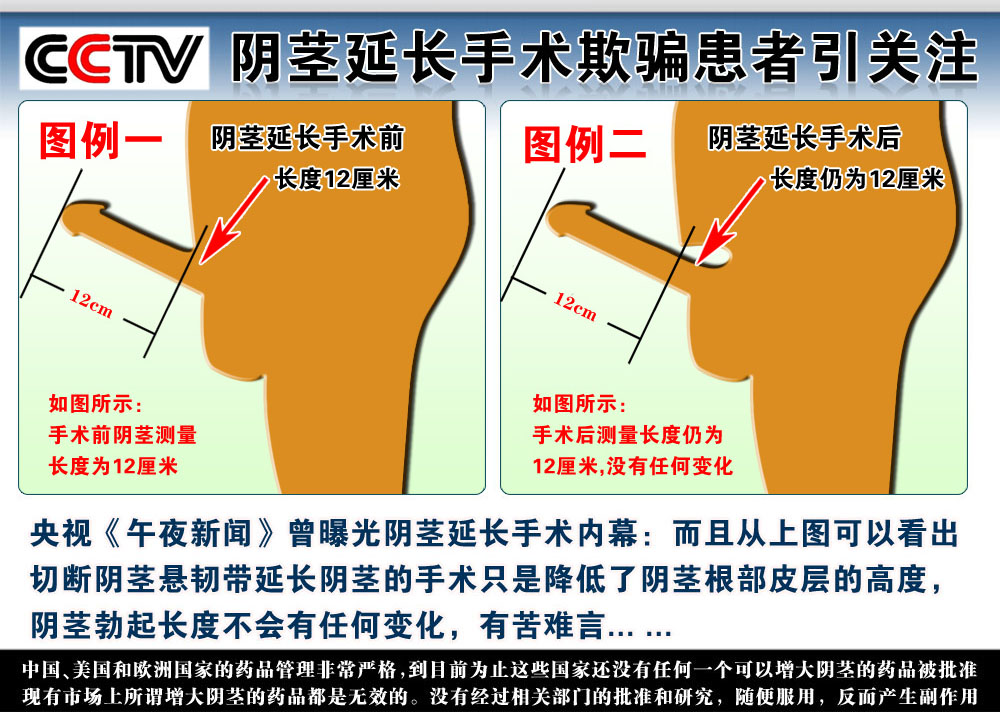 男性保健包括:睾丸保养,前列腺排毒,阴茎锻炼,前列腺炎排毒等几种男性